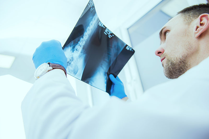 Doctor examining Gallbladder x-ray